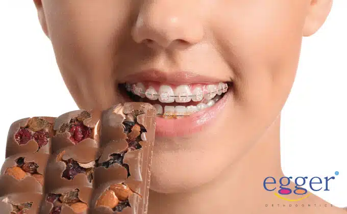 First Week with Braces: A Braces Diet and Care Guide