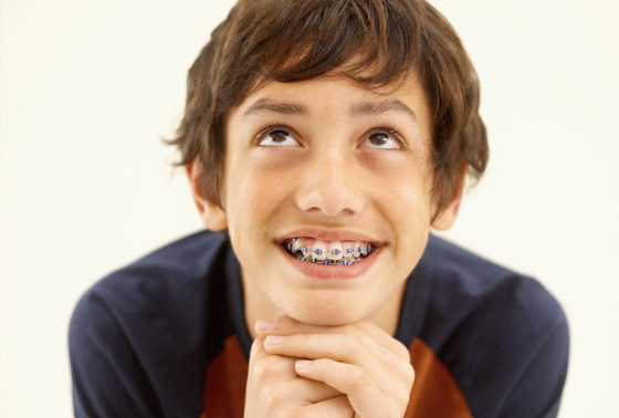 First Week with Braces