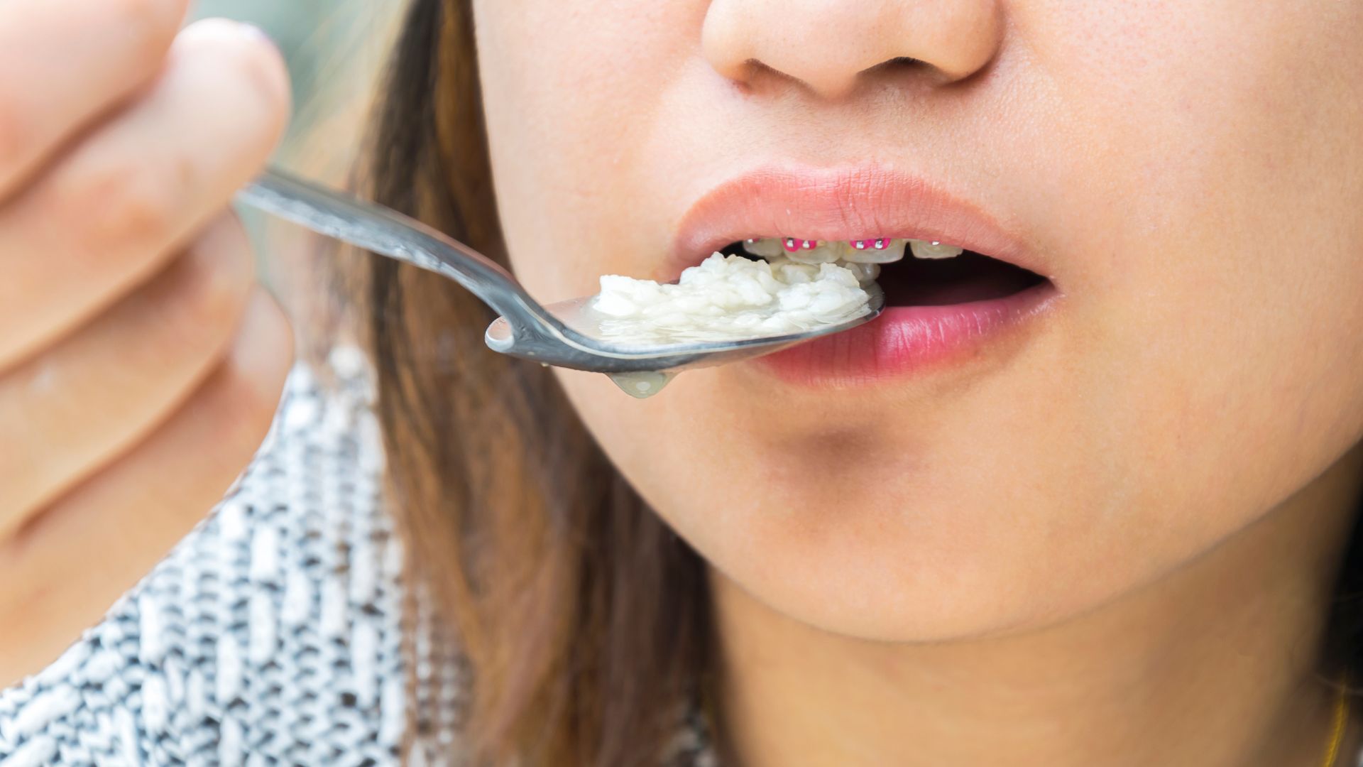 The Braces Diet