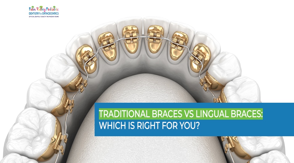 Braces Guide: First Week, Diet, and Flossing Routine