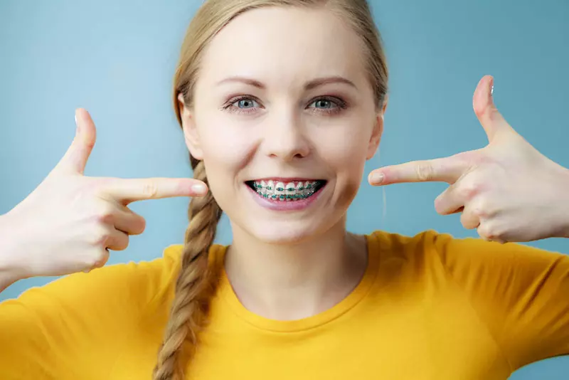 First Week with Braces