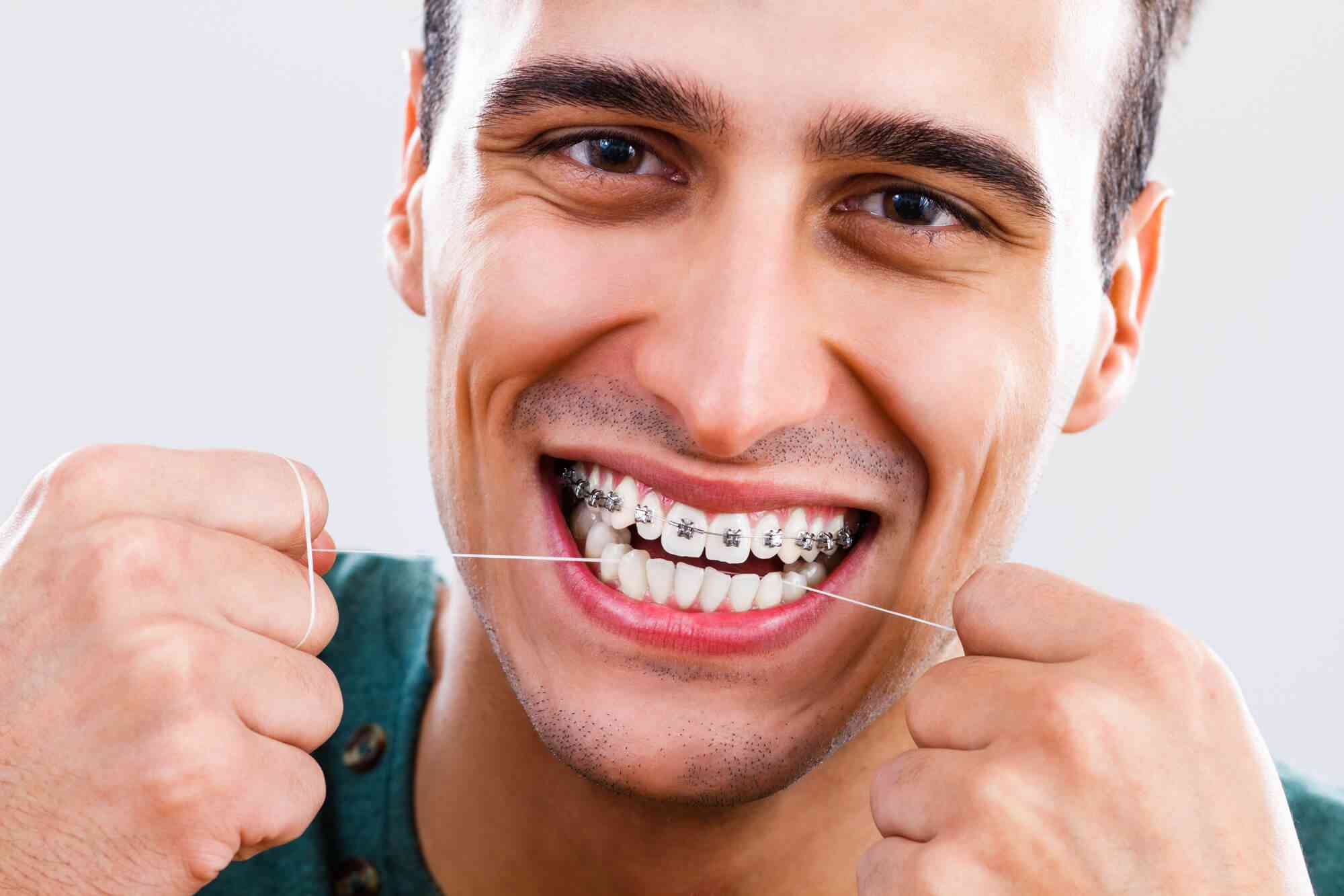 Invisalign or Braces? A First Week Survival Guide for New Patients