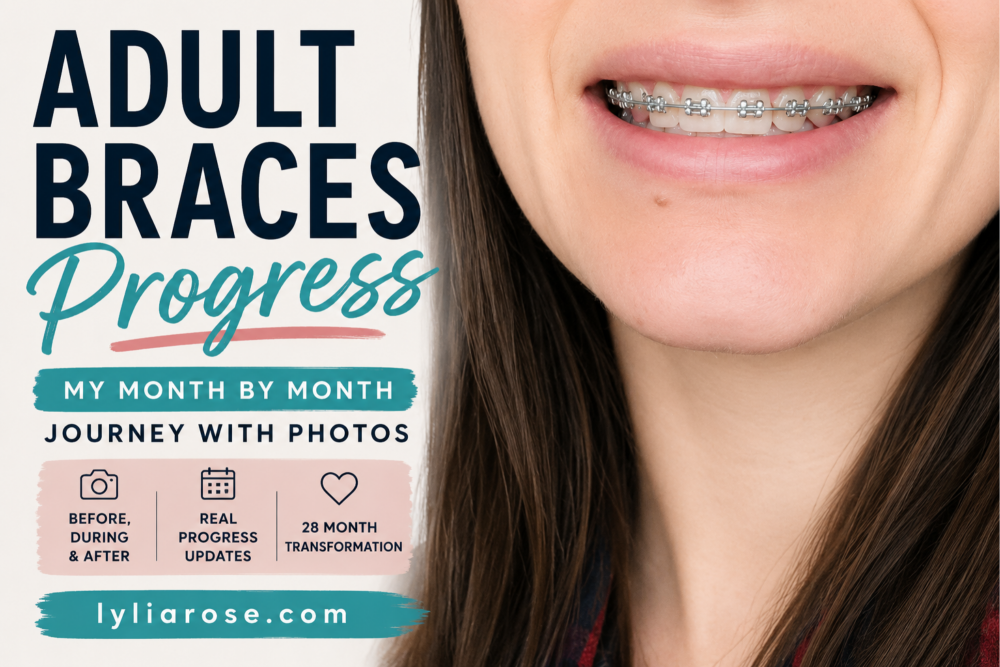 Braces Journey