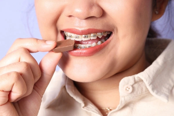 Braces Diet: What to Eat in Your First Week
