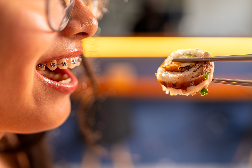 Braces Diet