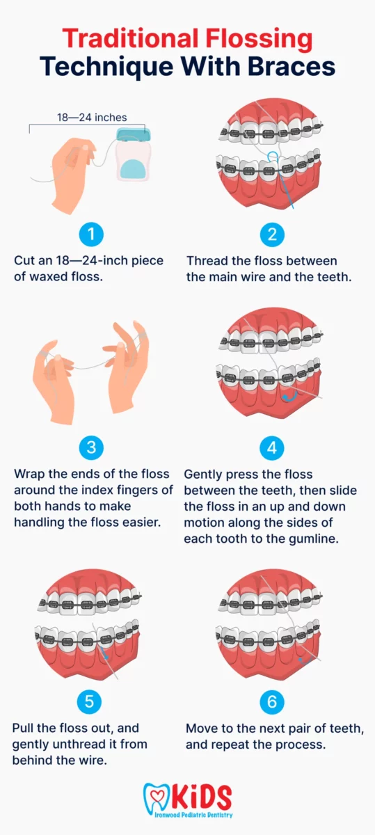 How to Floss with Braces Using 2026's Best Tools and Techniques: A Step-by-Step Guide