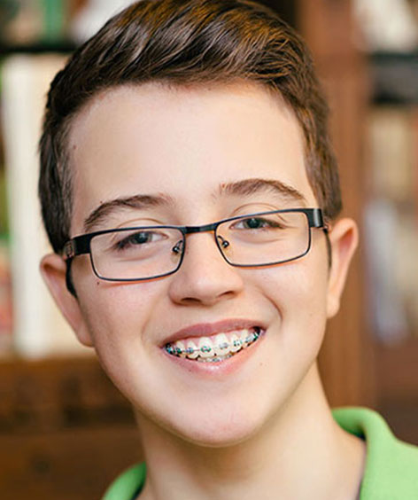 First Week with Braces