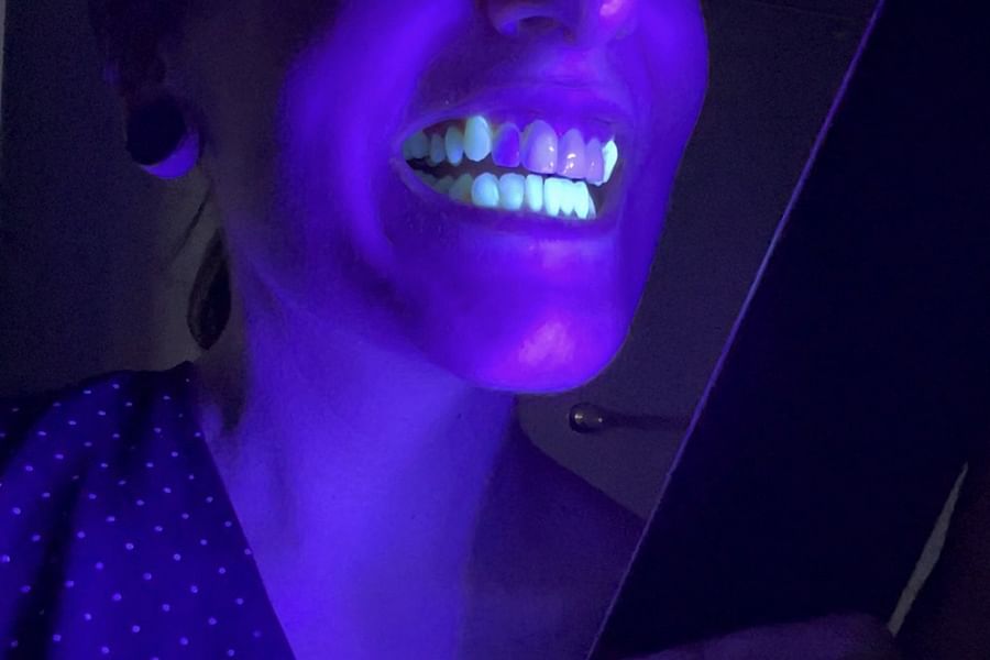 glow in the dark braces