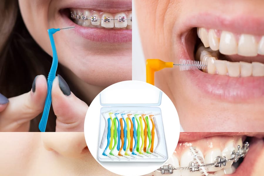 interdental brushes for braces