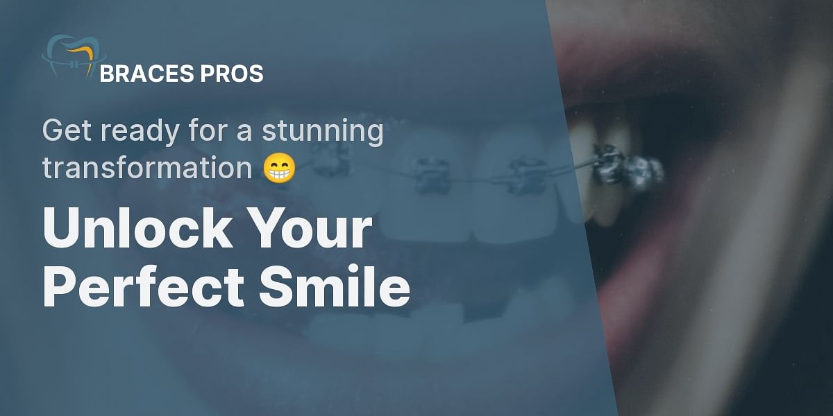 Your Roadmap to Braces A StepbyStep Guide Braces Pros
