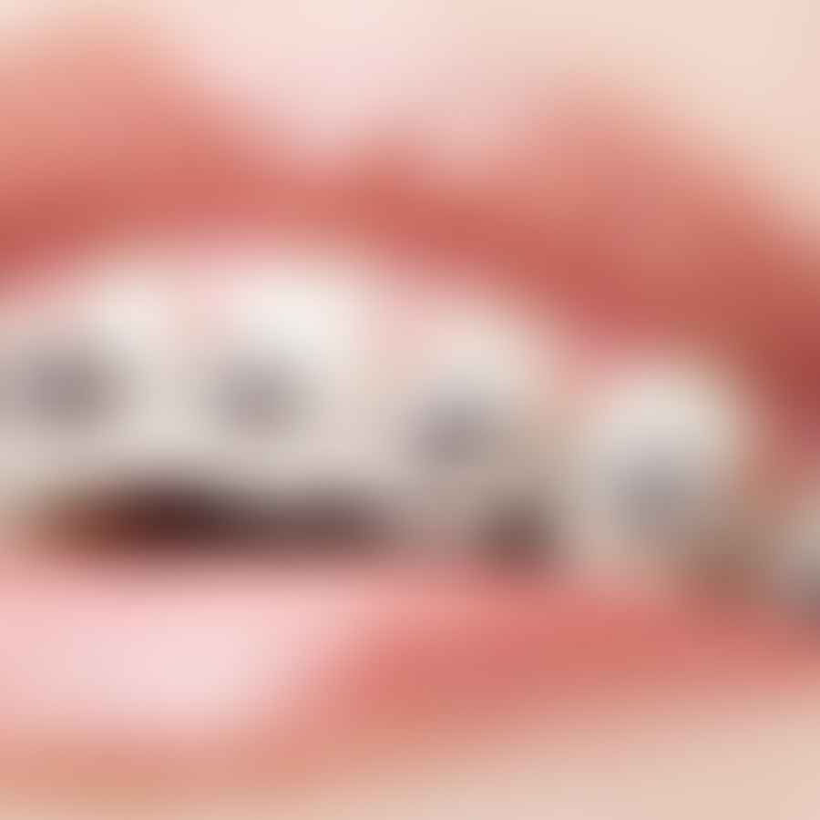 Close-up view of dental braces on teeth